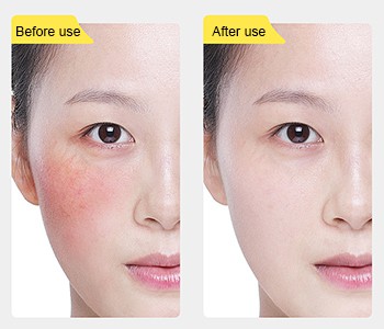 【Cel mai puternic ajutor】 de barieră a pielii - ectoină