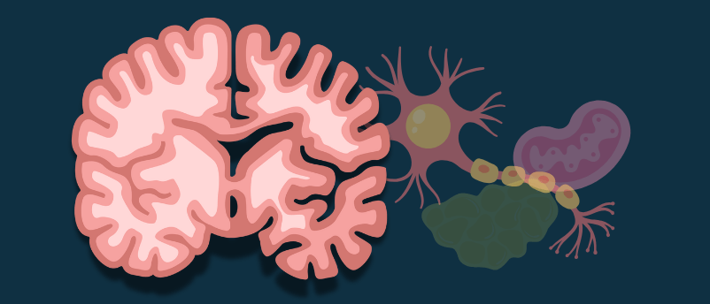Alzheimers disease Alzheimers disease
